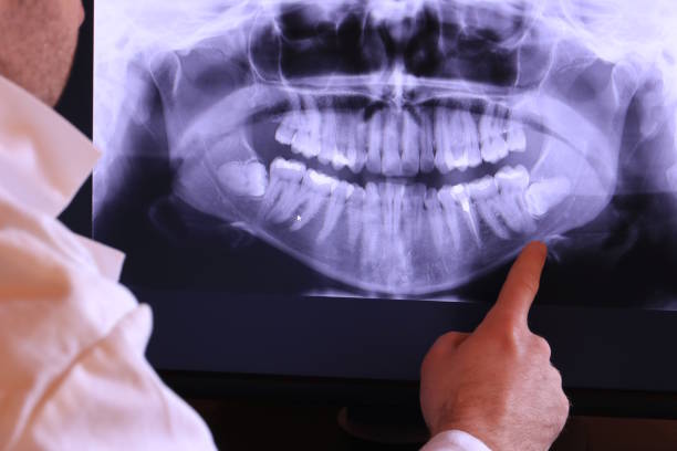 Best Walk-In Emergency Dental Services in Lake Fenton, MI